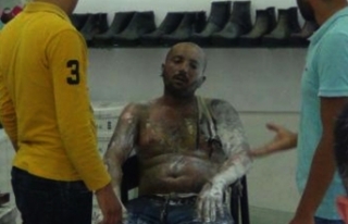 İşsiz genç benzin döküp kendini yaktı!