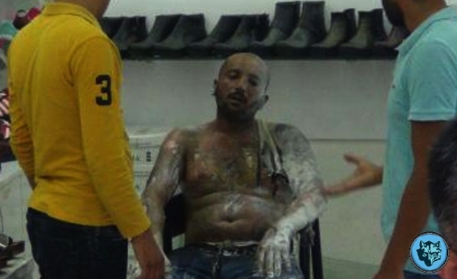 İşsiz genç benzin döküp kendini yaktı!